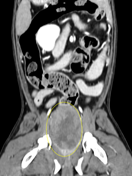94e62ed5723a30503d8471b780ac418b_1759109537_5752.jpg 94e62ed5723a30503d8471b780ac418b_1759109537_5752.jpg